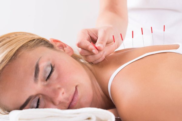 acupuncturist acupuncturist